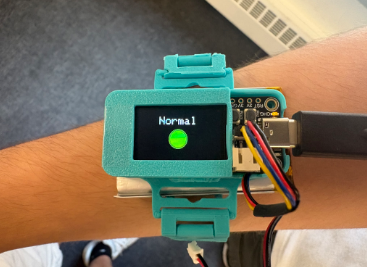 Device showing Normal status