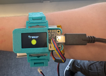Device showing Tremor status